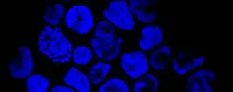 Human T-cell nuclei